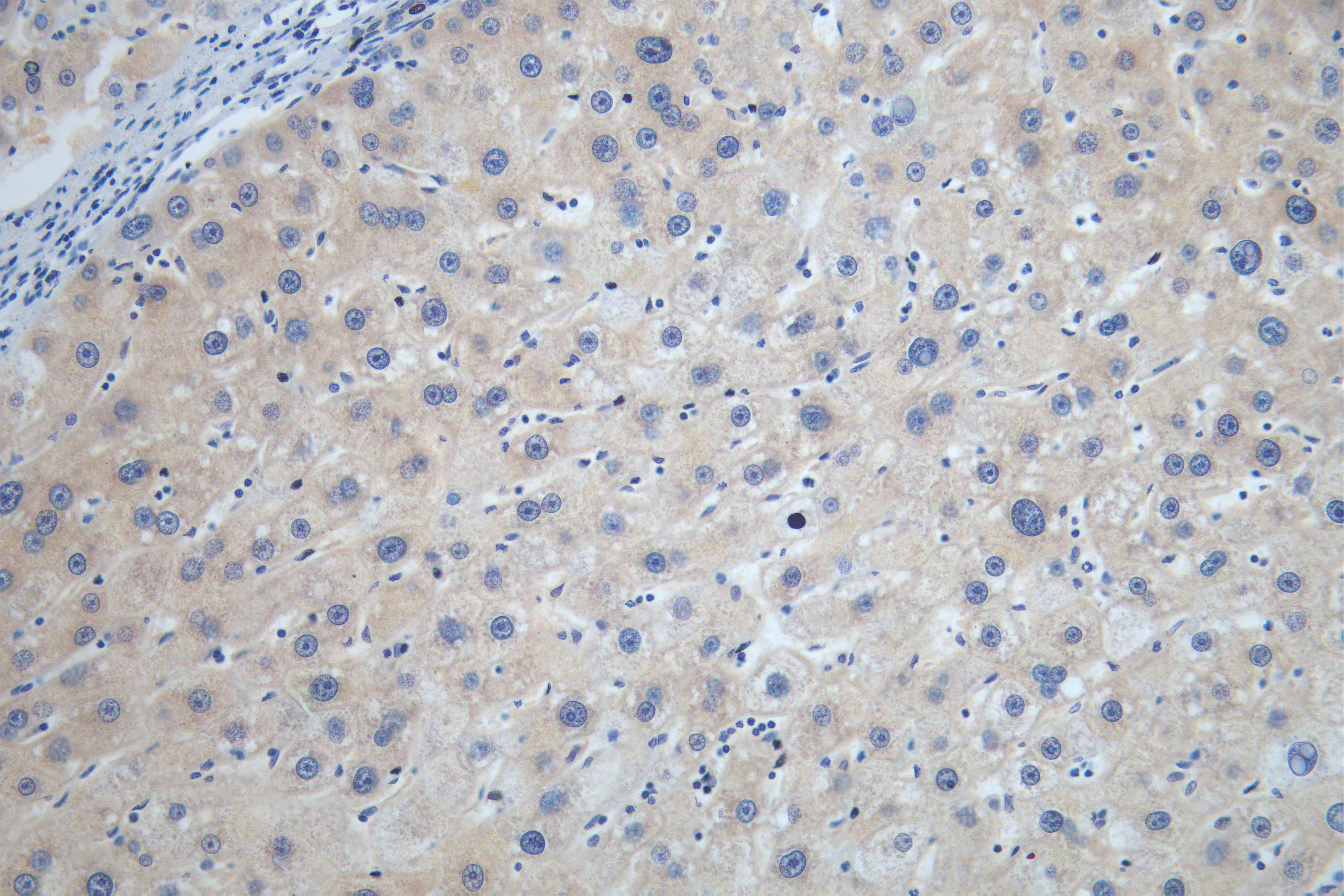 CSB-RA207790A0HU