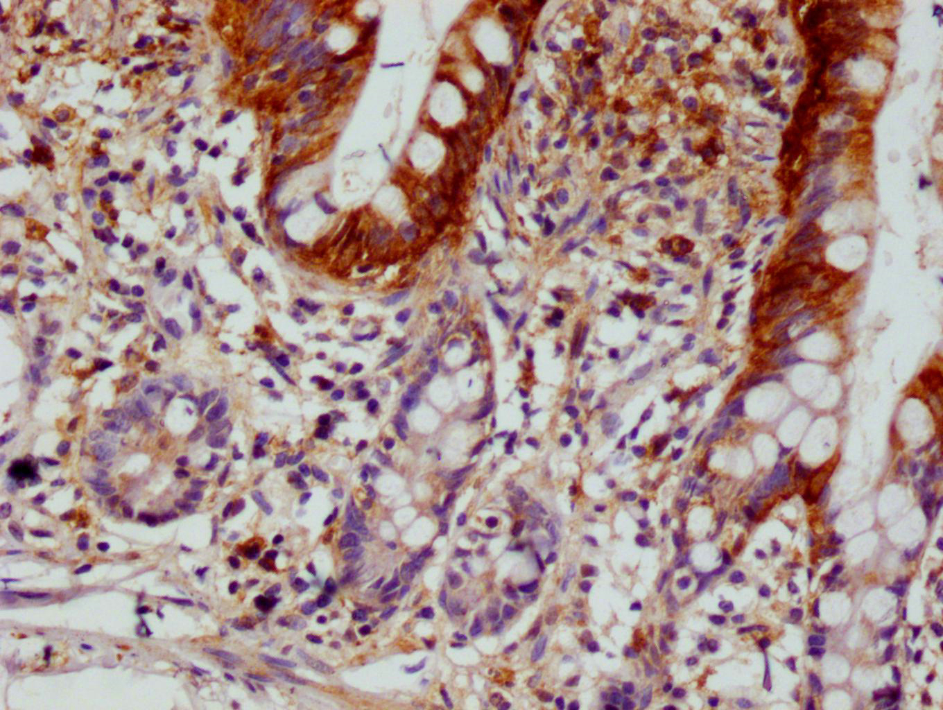 IHC image of CSB-RA213020A0HU diluted at 1:100 and staining in paraffin-embedded human small intestine tissue performed on a Leica BondTM system. After dewaxing and hydration, antigen retrieval was mediated by high pressure in a citrate buffer (pH 6.0). Section was blocked with 10% normal goat serum 30min at RT. Then primary antibody (1% BSA) was incubated at 4°C overnight. The primary is detected by a Goat anti-rabbit polymer IgG labeled by HRP and visualized using 0.05% DAB. IHC image of CSB-RA213020A0HU diluted at 1:100 and staining in paraffin-embedded human small intestine tissue performed on a Leica BondTM system. After dewaxing and hydration, antigen retrieval was mediated by high pressure in a citrate buffer (pH 6.0). Section was blocked with 10% normal goat serum 30min at RT. Then primary antibody (1% BSA) was incubated at 4°C overnight. The primary is detected by a Goat anti-rabbit polymer IgG labeled by HRP and visualized using 0.05% DAB.