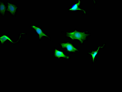 CSB-RA214107A0HU