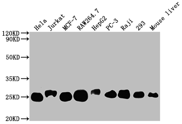CSB-RA214107A0HU