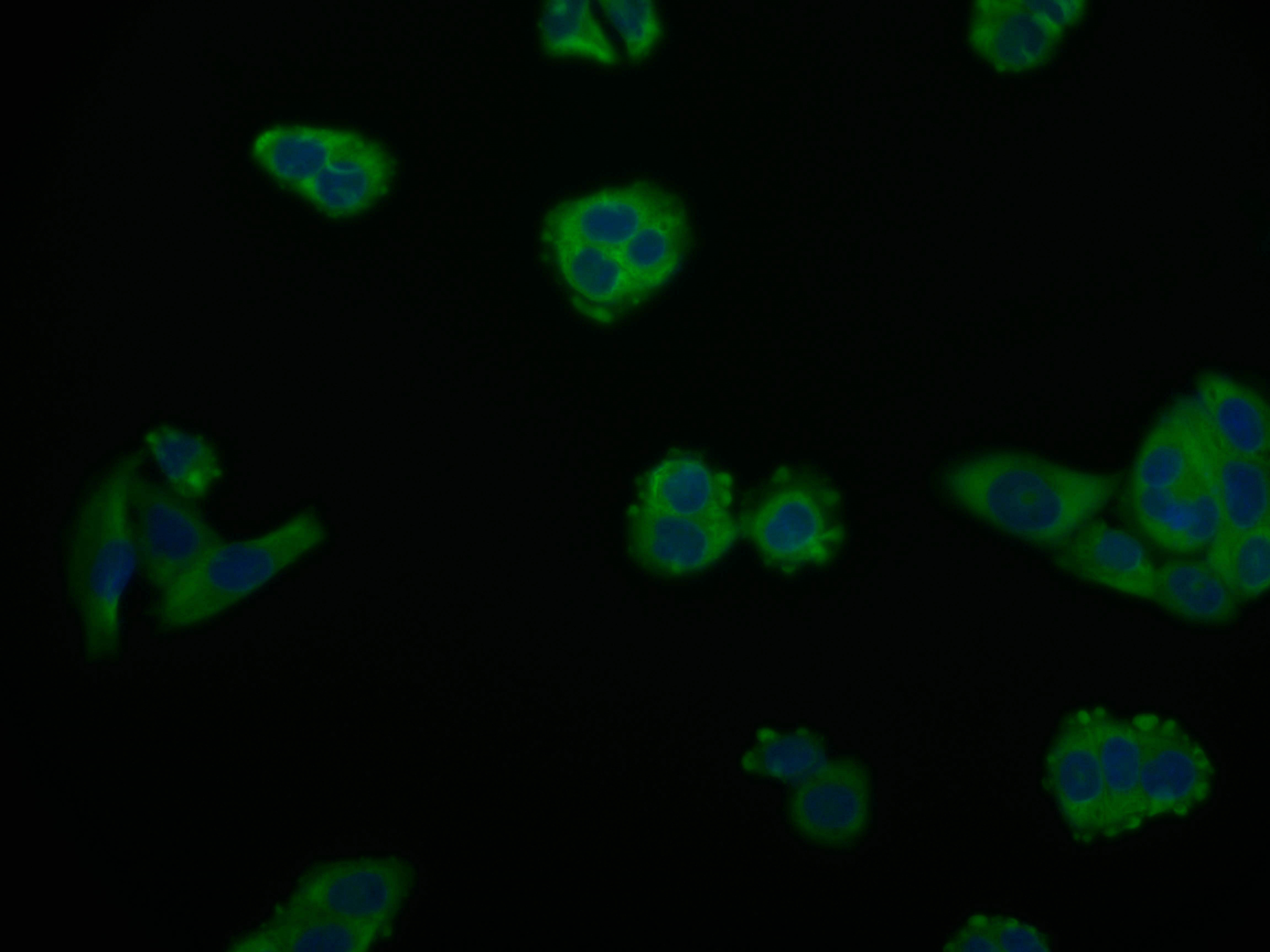 CSB-RA216908A0HU