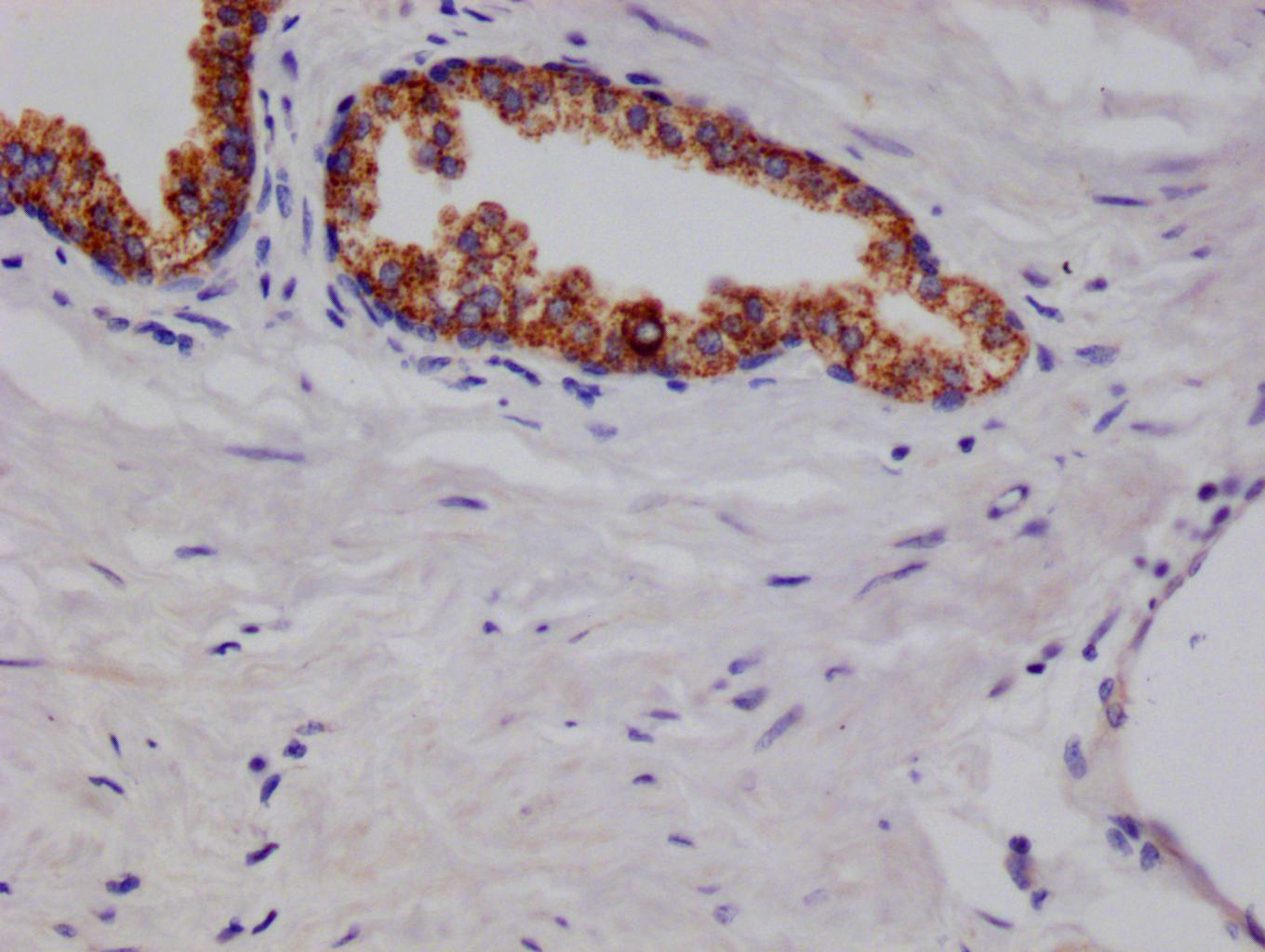 CSB-RA216908A0HU