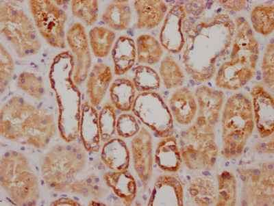 NDUFS3 Recombinant Monoclonal Antibody - image 2