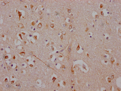 IHC image of CSB-RA224168A0HU diluted at 1:100 and staining in paraffin-embedded human brain tissue performed on a Leica BondTM system. After dewaxing and hydration, antigen retrieval was mediated by high pressure in a citrate buffer (pH 6.0). Section was blocked with 10% normal goat serum 30min at RT. Then primary antibody (1% BSA) was incubated at 4°C overnight. The primary is detected by a Goat anti-rabbit IgG polymer labeled by HRP and visualized using 0.05% DAB.