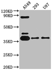 Western Blot Positive WB detected in: A549 whole cell lysate, 293 whole cell lysate, U87 whole cell lysate All lanes: ADORA1 antibody at 1:2000 Secondary Goat polyclonal to rabbit IgG at 1/50000 dilution Predicted band size: 37, 14 kDa Observed band size: 37 kDa Western Blot Positive WB detected in: A549 whole cell lysate, 293 whole cell lysate, U87 whole cell lysate All lanes: ADORA1 antibody at 1:2000 Secondary Goat polyclonal to rabbit IgG at 1/50000 dilution Predicted band size: 37, 14 kDa Observed band size: 37 kDa