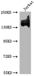 Western Blot Positive WB detected in: Jurkat whole cell lysate All lanes: ITGA4 antibody at 1:1500 Secondary Goat polyclonal to rabbit IgG at 1/50000 dilution Predicted band size: 115, 26 kDa Observed band size: 140 kDa Western Blot Positive WB detected in: Jurkat whole cell lysate All lanes: ITGA4 antibody at 1:1500 Secondary Goat polyclonal to rabbit IgG at 1/50000 dilution Predicted band size: 115, 26 kDa Observed band size: 140 kDa