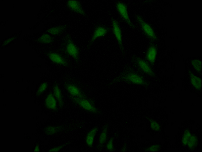 Immunofluorescence staining of Hela Cells with CSB-RA227095A0HU at 1:50, counter-stained with DAPI. The cells were fixed in 4% formaldehyde, permeated by 0.2% TritonX-100, and blocked in 10% normal Goat Serum. The cells were then incubated with the antibody overnight at 4°C. Nuclear DNA was labeled in blue with DAPI. The secondary antibody was FITC-conjugated AffiniPure Goat Anti-Rabbit IgG (H+L).