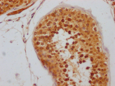 IHC image of CSB-RA227095A0HU diluted at 1:100 and staining in paraffin-embedded human testis tissue performed on a Leica BondTM system. After dewaxing and hydration, antigen retrieval was mediated by high pressure in a citrate buffer (pH 6.0). Section was blocked with 10% normal goat serum 30min at RT. Then primary antibody (1% BSA) was incubated at 4°C overnight. The primary is detected by a Goat anti-rabbit IgG polymer labeled by HRP and visualized using 0.05% DAB.