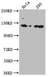 Western Blot Positive WB detected in: Hela whole cell lysate, 293 whole cell lysate All lanes: RNF20 antibody at 1:1000 Secondary Goat polyclonal to rabbit IgG at 1/50000 dilution Predicted band size: 114 kDa Observed band size: 114 kDa Western Blot Positive WB detected in: Hela whole cell lysate, 293 whole cell lysate All lanes: RNF20 antibody at 1:1000 Secondary Goat polyclonal to rabbit IgG at 1/50000 dilution Predicted band size: 114 kDa Observed band size: 114 kDa