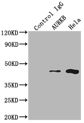Immunoprecipitating AURKB in Hela whole cell lysate Lane 1: Rabbit control IgG instead of CSB-RA230110A0HU in Hela whole cell lysate. For western blotting,a HRP-conjugated Protein G antibody was used as the secondary antibody (1/2000) Lane 2: CSB-RA230110A0HU(2microg)+ Hela whole cell lysate(500microg) Lane 3: Hela whole cell lysate (10microg)