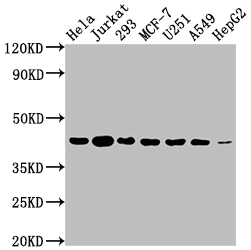 Western Blot Positive WB detected in: Hela whole cell lysate, Jurkat whole cell lysate, 293 whole cell lysate, MCF-7 whole cell lysate, U251 whole cell lysate, A549 whole cell lysate, HepG2 whole cell lysate All lanes: AURKB antibody at 1:2000 Secondary Goat polyclonal to rabbit IgG at 1/50000 dilution Predicted band size: 40, 36, 17, 35 kDa Observed band size: 40 kDa Western Blot Positive WB detected in: Hela whole cell lysate, Jurkat whole cell lysate, 293 whole cell lysate, MCF-7 whole cell lysate, U251 whole cell lysate, A549 whole cell lysate, HepG2 whole cell lysate All lanes: AURKB antibody at 1:2000 Secondary Goat polyclonal to rabbit IgG at 1/50000 dilution Predicted band size: 40, 36, 17, 35 kDa Observed band size: 40 kDa