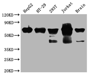 Western Blot Positive WB detected in: HepG2 whole cell lysate, HT-29 whole cell lysate, 293T whole cell lysate, Jurkat whole cell lysate, Mouse brain tissue All lanes: DDX5 antibody at 1:2000 Secondary Goat polyclonal to rabbit IgG at 1/50000 dilution Predicted band size: 70, 61 kDa Observed band size: 70 kDa Western Blot Positive WB detected in: HepG2 whole cell lysate, HT-29 whole cell lysate, 293T whole cell lysate, Jurkat whole cell lysate, Mouse brain tissue All lanes: DDX5 antibody at 1:2000 Secondary Goat polyclonal to rabbit IgG at 1/50000 dilution Predicted band size: 70, 61 kDa Observed band size: 70 kDa