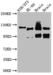 Western Blot Positive WB detected in: NIH/3T3 whole cell lysate, HL-60 whole cell lysate, Rat Brain whole cell lysate, Mouse Brain whole cell lysate All lanes: OGT antibody at 1:1000 Secondary Goat polyclonal to rabbit IgG at 1/50000 dilution Predicted band size: 117, 104, 116, 75 kDa Observed band size: 117 kDa Western Blot Positive WB detected in: NIH/3T3 whole cell lysate, HL-60 whole cell lysate, Rat Brain whole cell lysate, Mouse Brain whole cell lysate All lanes: OGT antibody at 1:1000 Secondary Goat polyclonal to rabbit IgG at 1/50000 dilution Predicted band size: 117, 104, 116, 75 kDa Observed band size: 117 kDa