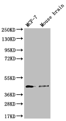 Western Blot Positive WB detected in: MCF-7 whole cell lysate, Mouse brain tissue All lanes: SLC27A4 antibody at 1:1000 Secondary Goat polyclonal to rabbit IgG at 1/50000 dilution Predicted band size: 73, 27 kDa Observed band size: 42 kDa Western Blot Positive WB detected in: MCF-7 whole cell lysate, Mouse brain tissue All lanes: SLC27A4 antibody at 1:1000 Secondary Goat polyclonal to rabbit IgG at 1/50000 dilution Predicted band size: 73, 27 kDa Observed band size: 42 kDa