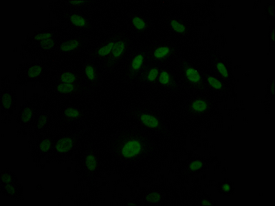 Immunofluorescence staining of Hela Cells with CSB-RA236860A0HU at 1:50, counter-stained with DAPI. The cells were fixed in 4% formaldehyde, permeated by 0.2% TritonX-100, and blocked in 10% normal Goat Serum. The cells were then incubated with the antibody overnight at 4°C. Nuclear DNA was labeled in blue with DAPI. The secondary antibody was FITC-conjugated AffiniPure Goat Anti-Rabbit IgG (H+L).