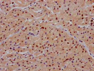 IHC image of CSB-RA236860A0HU diluted at 1:100 and staining in paraffin-embedded human heart tissue performed on a Leica BondTM system. After dewaxing and hydration, antigen retrieval was mediated by high pressure in a citrate buffer (pH 6.0). Section was blocked with 10% normal goat serum 30min at RT. Then primary antibody (1% BSA) was incubated at 4°C overnight. The primary is detected by a Goat anti-rabbit IgG polymer labeled by HRP and visualized using 0.05% DAB.