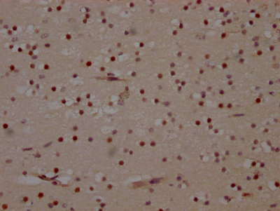 IHC image of CSB-RA236860A0HU diluted at 1:100 and staining in paraffin-embedded human brain tissue performed on a Leica BondTM system. After dewaxing and hydration, antigen retrieval was mediated by high pressure in a citrate buffer (pH 6.0). Section was blocked with 10% normal goat serum 30min at RT. Then primary antibody (1% BSA) was incubated at 4°C overnight. The primary is detected by a Goat anti-rabbit IgG polymer labeled by HRP and visualized using 0.05% DAB.