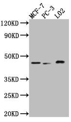 Western Blot Positive WB detected in: MCF-7 whole cell lysate, PC-3 whole cell lysate, L02 whole cell lysate All lanes: p38 antibody at 1:1000 Secondary Goat polyclonal to rabbit IgG at 1/50000 dilution Predicted band size: 42, 42, 35, 36 kDa Observed band size: 42 kDa Western Blot Positive WB detected in: MCF-7 whole cell lysate, PC-3 whole cell lysate, L02 whole cell lysate All lanes: p38 antibody at 1:1000 Secondary Goat polyclonal to rabbit IgG at 1/50000 dilution Predicted band size: 42, 42, 35, 36 kDa Observed band size: 42 kDa