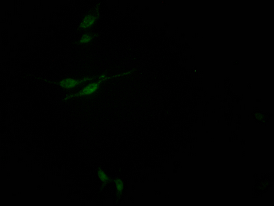 Immunofluorescence staining of HepG2 Cells with CSB-RA242724A0HU at 1:50, counter-stained with DAPI. The cells were fixed in 4% formaldehyde, permeated by 0.2% TritonX-100, and blocked in 10% normal Goat Serum. The cells were then incubated with the antibody overnight at 4°C. Nuclear DNA was labeled in blue with DAPI. The secondary antibody was FITC-conjugated AffiniPure Goat Anti-Rabbit IgG (H+L).
