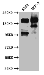 Western Blot Positive WB detected in: K562 whole cell lysate, MCF-7 whole cell lysate All lanes: mSin3A antibody at 1:1000 Secondary Goat polyclonal to rabbit IgG at 1/50000 dilution Predicted band size: 146 kDa Observed band size: 146 kDa Western Blot Positive WB detected in: K562 whole cell lysate, MCF-7 whole cell lysate All lanes: mSin3A antibody at 1:1000 Secondary Goat polyclonal to rabbit IgG at 1/50000 dilution Predicted band size: 146 kDa Observed band size: 146 kDa