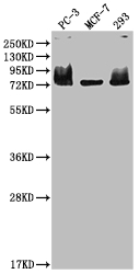 Western Blot Positive WB detected in: PC-3 whole cell lysate, MCF-7 whole cell lysate, 293 whole cell lysate All lanes: MEN1 antibody at 1:2000 Secondary Goat polyclonal to rabbit IgG at 1/50000 dilution Predicted band size: 69, 68, 64 kDa Observed band size: 75 kDa Western Blot Positive WB detected in: PC-3 whole cell lysate, MCF-7 whole cell lysate, 293 whole cell lysate All lanes: MEN1 antibody at 1:2000 Secondary Goat polyclonal to rabbit IgG at 1/50000 dilution Predicted band size: 69, 68, 64 kDa Observed band size: 75 kDa