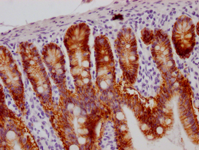 IHC image of CSB-RA245537A0HU diluted at 1:100 and staining in paraffin-embedded human small intestine tissue performed on a Leica BondTM system. After dewaxing and hydration, antigen retrieval was mediated by high pressure in a citrate buffer (pH 6.0). Section was blocked with 10% normal goat serum 30min at RT. Then primary antibody (1% BSA) was incubated at 4°C overnight. The primary is detected by a Goat anti-rabbit IgG polymer labeled by HRP and visualized using 0.05% DAB. IHC image of CSB-RA245537A0HU diluted at 1:100 and staining in paraffin-embedded human small intestine tissue performed on a Leica BondTM system. After dewaxing and hydration, antigen retrieval was mediated by high pressure in a citrate buffer (pH 6.0). Section was blocked with 10% normal goat serum 30min at RT. Then primary antibody (1% BSA) was incubated at 4°C overnight. The primary is detected by a Goat anti-rabbit IgG polymer labeled by HRP and visualized using 0.05% DAB.
