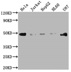 Western Blot Positive WB detected in: Hela whole cell lysate, Jurkat whole cell lysate, HepG2 whole cell lysate, HL60 whole cell lysate, U87 whole cell lysate All lanes: FAS antibody at 1:2000 Secondary Goat polyclonal to rabbit IgG at 1/50000 dilution Predicted band size: 38, 12, 10, 17, 15, 36, 25 kDa Observed band size: 45 kDa Western Blot Positive WB detected in: Hela whole cell lysate, Jurkat whole cell lysate, HepG2 whole cell lysate, HL60 whole cell lysate, U87 whole cell lysate All lanes: FAS antibody at 1:2000 Secondary Goat polyclonal to rabbit IgG at 1/50000 dilution Predicted band size: 38, 12, 10, 17, 15, 36, 25 kDa Observed band size: 45 kDa