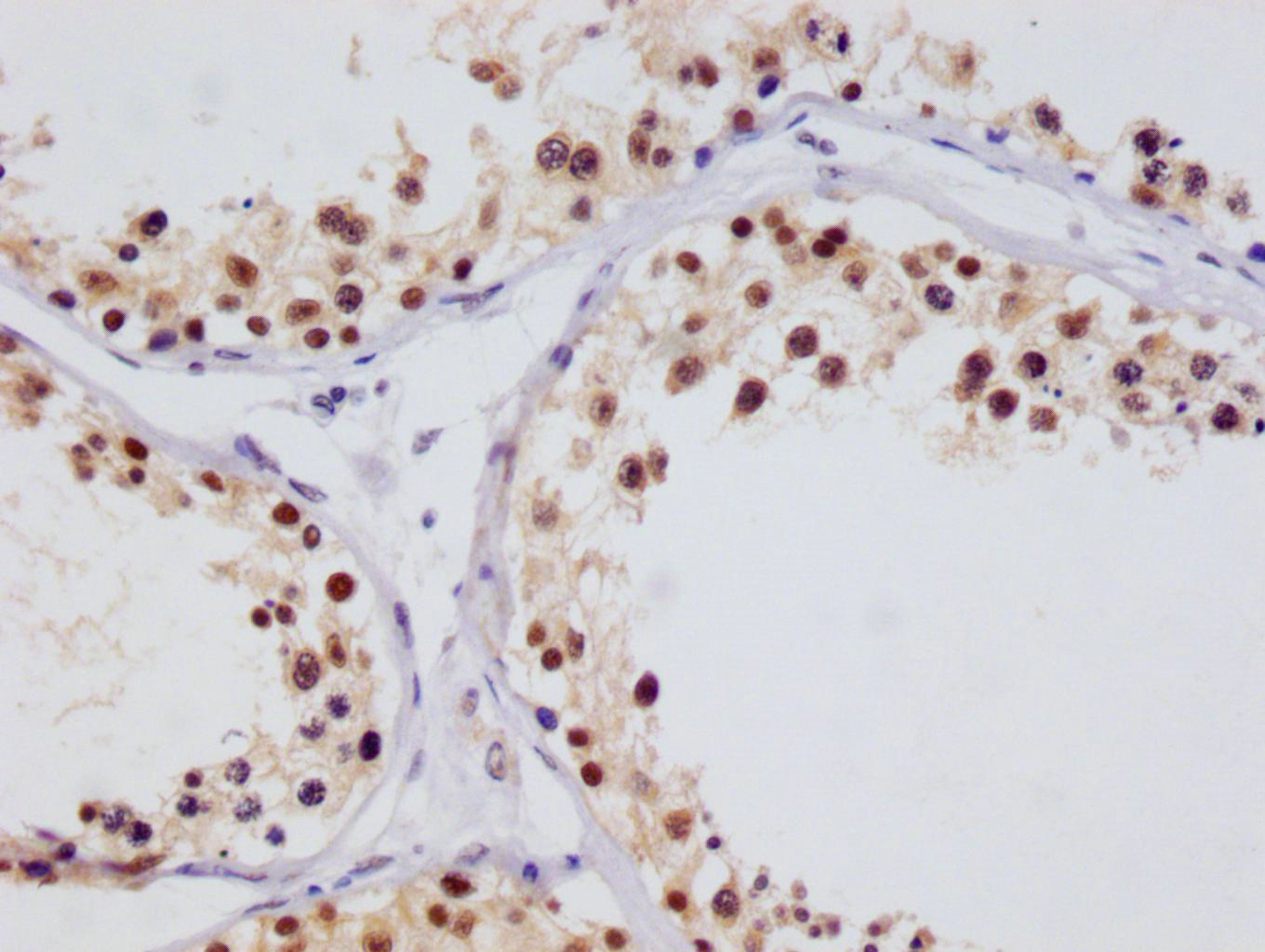IHC image of CSB-RA256295A0HU diluted at 1:100 and staining in paraffin-embedded human testis tissue performed on a Leica BondTM system. After dewaxing and hydration, antigen retrieval was mediated by high pressure in a citrate buffer (pH 6.0). Section was blocked with 10% normal goat serum 30min at RT. Then primary antibody (1% BSA) was incubated at 4°C overnight. The primary is detected by a Goat anti-rabbit polymer IgG labeled by HRP and visualized using 0.05% DAB.