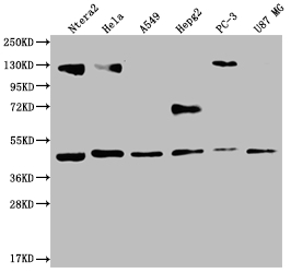 Western Blot Positive WB detected in: Ntera-2 whole cell lysate, Hela whole cell lysate, A549 whole cell lysate, HepG2 whole cell lysate, PC3 whole cell lysate, U87 whole cell lysate All lanes: HIF1AN antibody at 1:2000 Secondary Goat polyclonal to rabbit IgG at 1/50000 dilution Predicted band size: 41 kDa Observed band size: 36-53 kDa Western Blot Positive WB detected in: Ntera-2 whole cell lysate, Hela whole cell lysate, A549 whole cell lysate, HepG2 whole cell lysate, PC3 whole cell lysate, U87 whole cell lysate All lanes: HIF1AN antibody at 1:2000 Secondary Goat polyclonal to rabbit IgG at 1/50000 dilution Predicted band size: 41 kDa Observed band size: 36-53 kDa