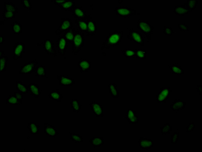 IKBKB Recombinant Monoclonal Antibody - image 3