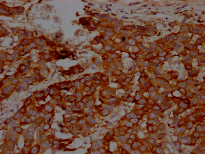 IKBKB Recombinant Monoclonal Antibody - image 2