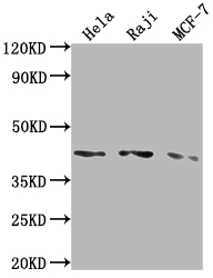 Western Blot Positive WB detected in: Hela whole cell lysate, Raji whole cell lysate, MCF-7 whole cell lysate All lanes: AGTR1 antibody at 1:2000 Secondary Goat polyclonal to rabbit IgG at 1/50000 dilution Predicted band size: 42 kDa Observed band size: 42 kDa Western Blot Positive WB detected in: Hela whole cell lysate, Raji whole cell lysate, MCF-7 whole cell lysate All lanes: AGTR1 antibody at 1:2000 Secondary Goat polyclonal to rabbit IgG at 1/50000 dilution Predicted band size: 42 kDa Observed band size: 42 kDa