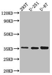 Western Blot Positive WB detected in: 293T whole cell lysate, U-251 whole cell lysate, U-87 whole cell lysate All lanes: Osteopontin Antibody at 1:1000 Secondary Goat polyclonal to rabbit IgG at 1/50000 dilution Predicted band size: 36, 34, 33, 34, 34 kDa Observed band size: 36 kDa Western Blot Positive WB detected in: 293T whole cell lysate, U-251 whole cell lysate, U-87 whole cell lysate All lanes: Osteopontin Antibody at 1:1000 Secondary Goat polyclonal to rabbit IgG at 1/50000 dilution Predicted band size: 36, 34, 33, 34, 34 kDa Observed band size: 36 kDa