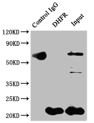 Immunoprecipitating DHFR in Hela whole cell lysate Lane 1: Rabbit control IgG instead of CSB-RA264582A0HU in Hela whole cell lysate. For western blotting,a HRP-conjugated Protein G antibody was used as the secondary antibody (1/2000) Lane 2: CSB-RA264582A0HU(2microg)+ Hela whole cell lysate(500microg) Lane 3: Hela whole cell lysate (10microg)