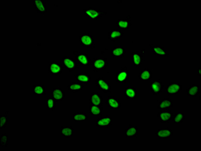 Immunofluorescence staining of Hela Cells with CSB-RA273277A0HU at 1:50, counter-stained with DAPI. The cells were fixed in 4% formaldehyde, permeated by 0.2% TritonX-100, and blocked in 10% normal Goat Serum. The cells were then incubated with the antibody overnight at 4°C. Nuclear DNA was labeled in blue with DAPI. The secondary antibody was FITC-conjugated AffiniPure Goat Anti-Rabbit IgG (H+L).