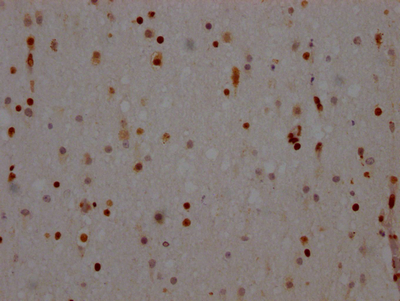 IHC image of CSB-RA273277A0HU diluted at 1:100 and staining in paraffin-embedded human brain tissue performed on a Leica BondTM system. After dewaxing and hydration, antigen retrieval was mediated by high pressure in a citrate buffer (pH 6.0). Section was blocked with 10% normal goat serum 30min at RT. Then primary antibody (1% BSA) was incubated at 4°C overnight. The primary is detected by a Goat anti-rabbit IgG polymer labeled by HRP and visualized using 0.05% DAB.