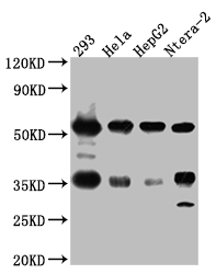 Western Blot Positive WB detected in: 293 whole cell lysate, Hela whole cell lysate, HepG2 whole cell lysate, Ntera-2 whole cell lysate All lanes: NONO Antibody at 1:1000 Secondary Goat polyclonal to rabbit IgG at 1/50000 dilution Predicted band size: 55, 44 kDa Observed band size: 55 kDa Western Blot Positive WB detected in: 293 whole cell lysate, Hela whole cell lysate, HepG2 whole cell lysate, Ntera-2 whole cell lysate All lanes: NONO Antibody at 1:1000 Secondary Goat polyclonal to rabbit IgG at 1/50000 dilution Predicted band size: 55, 44 kDa Observed band size: 55 kDa