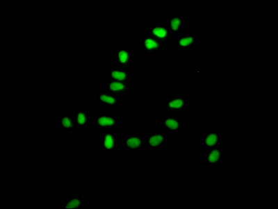 Immunofluorescence staining of Hela Cells with CSB-RA276627A0HU at 1:50, counter-stained with DAPI. The cells were fixed in 4% formaldehyde, permeated by 0.2% TritonX-100, and blocked in 10% normal Goat Serum. The cells were then incubated with the antibody overnight at 4°C. Nuclear DNA was labeled in blue with DAPI. The secondary antibody was FITC-conjugated AffiniPure Goat Anti-Rabbit IgG (H+L).
