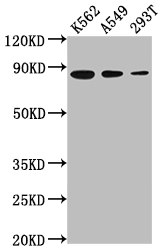 Western Blot Positive WB detected in: K562 whole cell lysate, A549 whole cell lysate, 293T whole cell lysate All lanes: XRCC5 antibody at 1:2000 Secondary Goat polyclonal to rabbit IgG at 1/50000 dilution Predicted band size: 83 kDa Observed band size: 83 kDa Western Blot Positive WB detected in: K562 whole cell lysate, A549 whole cell lysate, 293T whole cell lysate All lanes: XRCC5 antibody at 1:2000 Secondary Goat polyclonal to rabbit IgG at 1/50000 dilution Predicted band size: 83 kDa Observed band size: 83 kDa