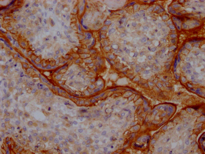 IHC image of CSB-RA279866A0HU diluted at 1:100 and staining in paraffin-embedded human placenta tissue performed on a Leica BondTM system. After dewaxing and hydration, antigen retrieval was mediated by high pressure in a citrate buffer (pH 6.0). Section was blocked with 10% normal goat serum 30min at RT. Then primary antibody (1% BSA) was incubated at 4°C overnight. The primary is detected by a Goat anti-rabbit IgG polymer labeled by HRP and visualized using 0.05% DAB.