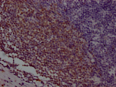 IHC image of CSB-RA280291A0HU diluted at 1:100 and staining in paraffin-embedded human appendix tissue performed on a Leica BondTM system. After dewaxing and hydration, antigen retrieval was mediated by high pressure in a citrate buffer (pH 6.0). Section was blocked with 10% normal goat serum 30min at RT. Then primary antibody (1% BSA) was incubated at 4°C overnight. The primary is detected by a Goat anti-rabbit IgG polymer labeled by HRP and visualized using 0.05% DAB.