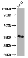 Western Blot Positive WB detected in: Raji whole cell lysate All lanes: BOB1 antibody at 1:2000 Secondary Goat polyclonal to rabbit IgG at 1/50000 dilution Predicted band size: 28 kDa Observed band size: 35 kDa Western Blot Positive WB detected in: Raji whole cell lysate All lanes: BOB1 antibody at 1:2000 Secondary Goat polyclonal to rabbit IgG at 1/50000 dilution Predicted band size: 28 kDa Observed band size: 35 kDa