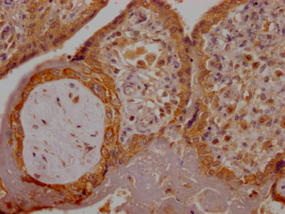 IHC image of CSB-RA280380A0HU diluted at 1:100 and staining in paraffin-embedded human placenta tissue performed on a Leica BondTM system. After dewaxing and hydration, antigen retrieval was mediated by high pressure in a citrate buffer (pH 6.0). Section was blocked with 10% normal goat serum 30min at RT. Then primary antibody (1% BSA) was incubated at 4°C overnight. The primary is detected by a Goat anti-rabbit IgG polymer labeled by HRP and visualized using 0.05% DAB.