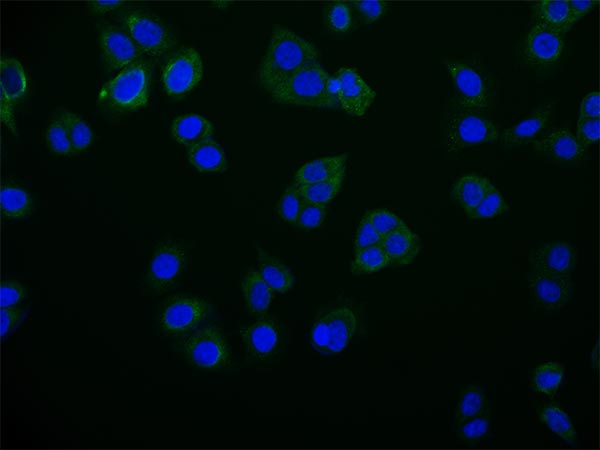 Immunofluorescence validation of RAB25 Recombinant Monoclonal Antibody