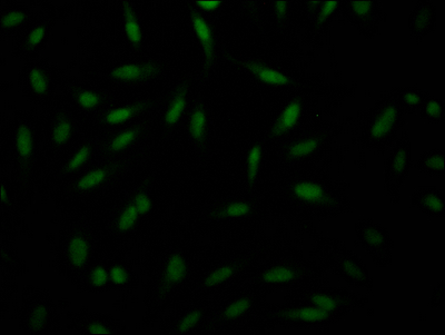 Immunofluorescence staining of Hela Cells with CSB-RA287160A0HU at 1:50, counter-stained with DAPI. The cells were fixed in 4% formaldehyde, permeated by 0.2% TritonX-100, and blocked in 10% normal Goat Serum. The cells were then incubated with the antibody overnight at 4°C. Nuclear DNA was labeled in blue with DAPI. The secondary antibody was FITC-conjugated AffiniPure Goat Anti-Rabbit IgG (H+L). Immunofluorescence staining of Hela Cells with CSB-RA287160A0HU at 1:50, counter-stained with DAPI. The cells were fixed in 4% formaldehyde, permeated by 0.2% TritonX-100, and blocked in 10% normal Goat Serum. The cells were then incubated with the antibody overnight at 4°C. Nuclear DNA was labeled in blue with DAPI. The secondary antibody was FITC-conjugated AffiniPure Goat Anti-Rabbit IgG (H+L).