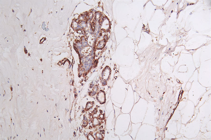 CSB-RA289956A0HU