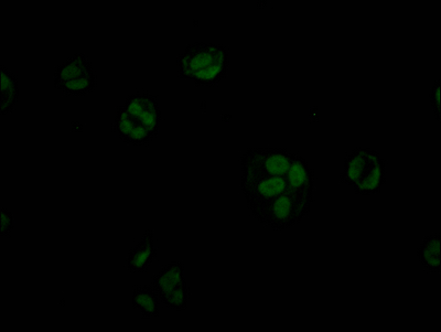 STAG2 Recombinant Monoclonal Antibody - image 2