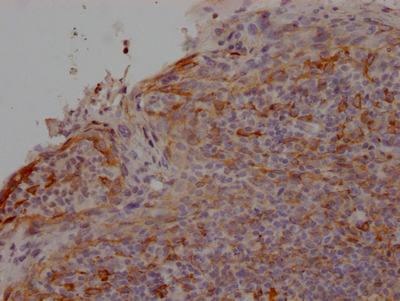 IHC image of CSB-RA297464A0HU diluted at 1:100 and staining in paraffin-embedded human tonsil tissue performed on a Leica BondTM system. After dewaxing and hydration, antigen retrieval was mediated by high pressure in a citrate buffer (pH 6.0). Section was blocked with 10% normal goat serum 30min at RT. Then primary antibody (1% BSA) was incubated at 4°C overnight. The primary is detected by a Goat anti-rabbit IgG polymer labeled by HRP and visualized using 0.05% DAB. IHC image of CSB-RA297464A0HU diluted at 1:100 and staining in paraffin-embedded human tonsil tissue performed on a Leica BondTM system. After dewaxing and hydration, antigen retrieval was mediated by high pressure in a citrate buffer (pH 6.0). Section was blocked with 10% normal goat serum 30min at RT. Then primary antibody (1% BSA) was incubated at 4°C overnight. The primary is detected by a Goat anti-rabbit IgG polymer labeled by HRP and visualized using 0.05% DAB.