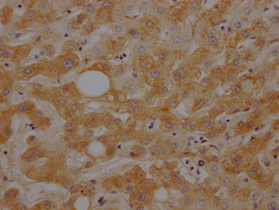 IHC image of CSB-RA303909A0HU diluted at 1:100 and staining in paraffin-embedded human liver tissue performed on a Leica BondTM system. After dewaxing and hydration, antigen retrieval was mediated by high pressure in a citrate buffer (pH 6.0). Section was blocked with 10% normal goat serum 30min at RT. Then primary antibody (1% BSA) was incubated at 4°C overnight. The primary is detected by a Goat anti-rabbit IgG polymer labeled by HRP and visualized using 0.05% DAB.
