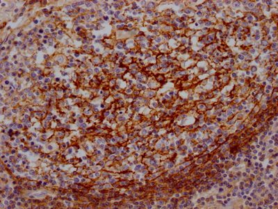 IHC image of CSB-RA440943A0HU diluted at 1:100 and staining in paraffin-embedded human lung tissue performed on a Leica BondTM system. After dewaxing and hydration, antigen retrieval was mediated by high pressure in a citrate buffer (pH 6.0). Section was blocked with 10% normal goat serum 30min at RT. Then primary antibody (1% BSA) was incubated at 4°C overnight. The primary is detected by a Goat anti-rabbit IgG polymer labeled by HRP and visualized using 0.05% DAB.